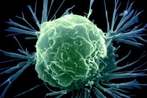 Международная группа ученых заявила о прорыве в лечении рака