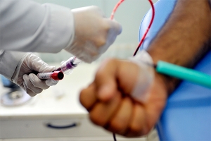 На Ставрополье прогрессирование ВИЧ остановили у 97% зараженных